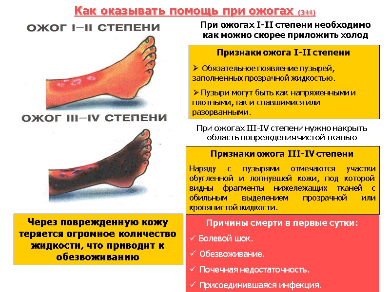 Как оказывать помощь при ожогах (344) Через поврежденную кожу теряется огромное количество жидкости, что